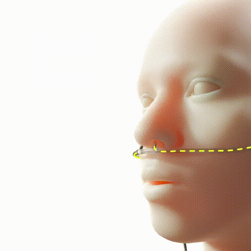 A Novama Expert MOCX3 pulzáló áramlás mechanizmusa